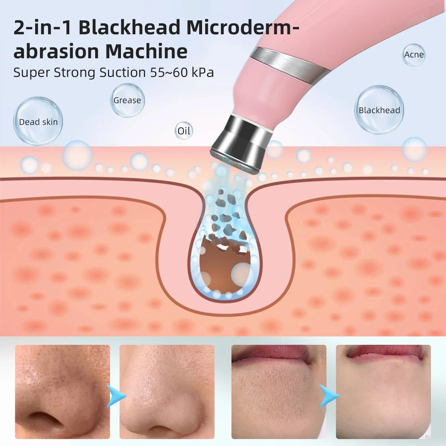 Professional Diamond Microdermabrasion Machine – At-Home Facial Peeling & Deep Cleaning Skin Care Tool