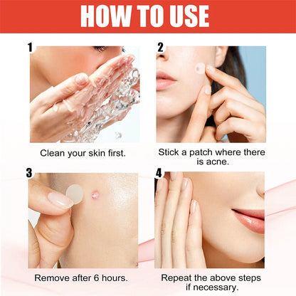 144pcs Face Acne Pimple Patch Set – 2 Sizes Invisible Professional Healing Spot Stickers for Men & Women Skin Care