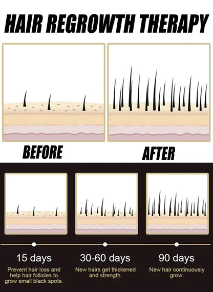 2026 Anti Hair Loss Essence for Scalp Care, Hair Growth Support & Improved Scalp Health