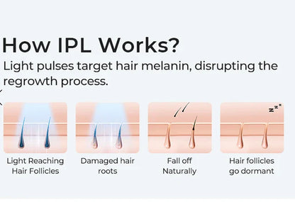 Body Bikini IPL Hair Removal Device – 999,999 Flashes, Permanent Painless Laser Epilator for Women, Home Use
