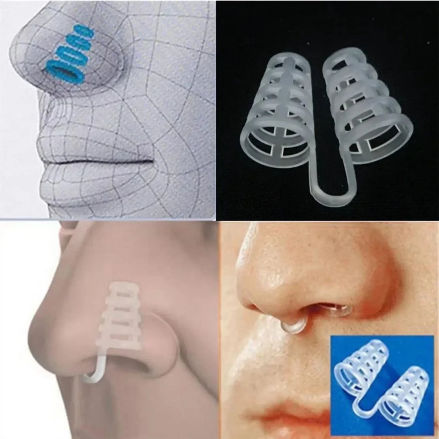 Anti-Snoring Nasal Dilators - Breathe Easy Sleep Aid Cones for Improved Airflow & Congestion Relief