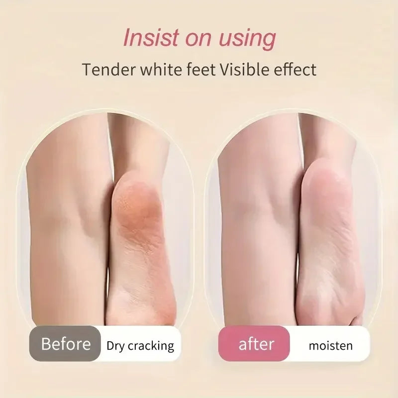 2PCS Silicone Foot Care Socks – Moisturizing, Softening Dry & Cracked Heels for Men & Women