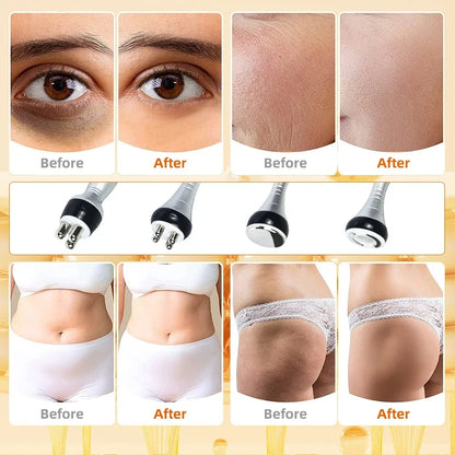 40K 3-in-1/4-in-1 Cavitation Body Slimming Machine – Facial Massager, Skin Tightening, Face Lifting & Vacuum Suction Beauty Device