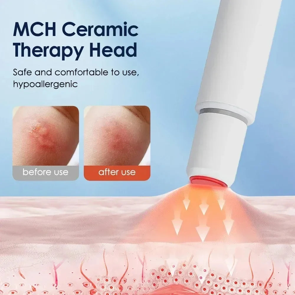 Portable Heat Therapy Bug Bite Relief Pen - Electric Mosquito Bite Itch Relief Device for Outdoor Travel & Daily Use