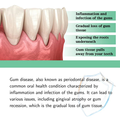 Gum Repair Oral Care Drops - Periodontal Hygiene Treatment for Gum Cleaning & Stain Removal