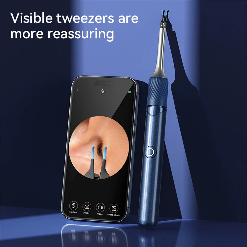 Visual Ear Cleaner with Camera – Ear Wax Removal Tool with 12MP, Ear Pick, Tweezers & 6 Ear Spoons for Ear Care