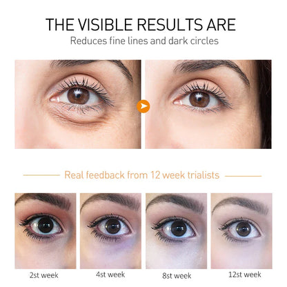 OCHEAL Eye Moisturizing Cream – Anti-Aging Serum for Dark Circles, Fine Lines, Puffiness, and Firmness