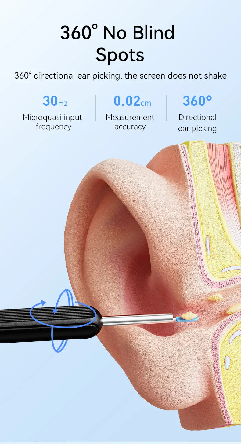 Wireless Ear Wax Cleaner with Camera – Safe Earwax Removal Endoscope with LED Light, Ear Cleaning Tool for Ear Care