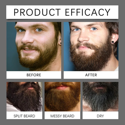East Moon Beard Growth Serum Set – Hair & Whisker Growth Oil for Strengthening Roots, Moisturizing Skin & Softening Beard Care Hydration Treatment