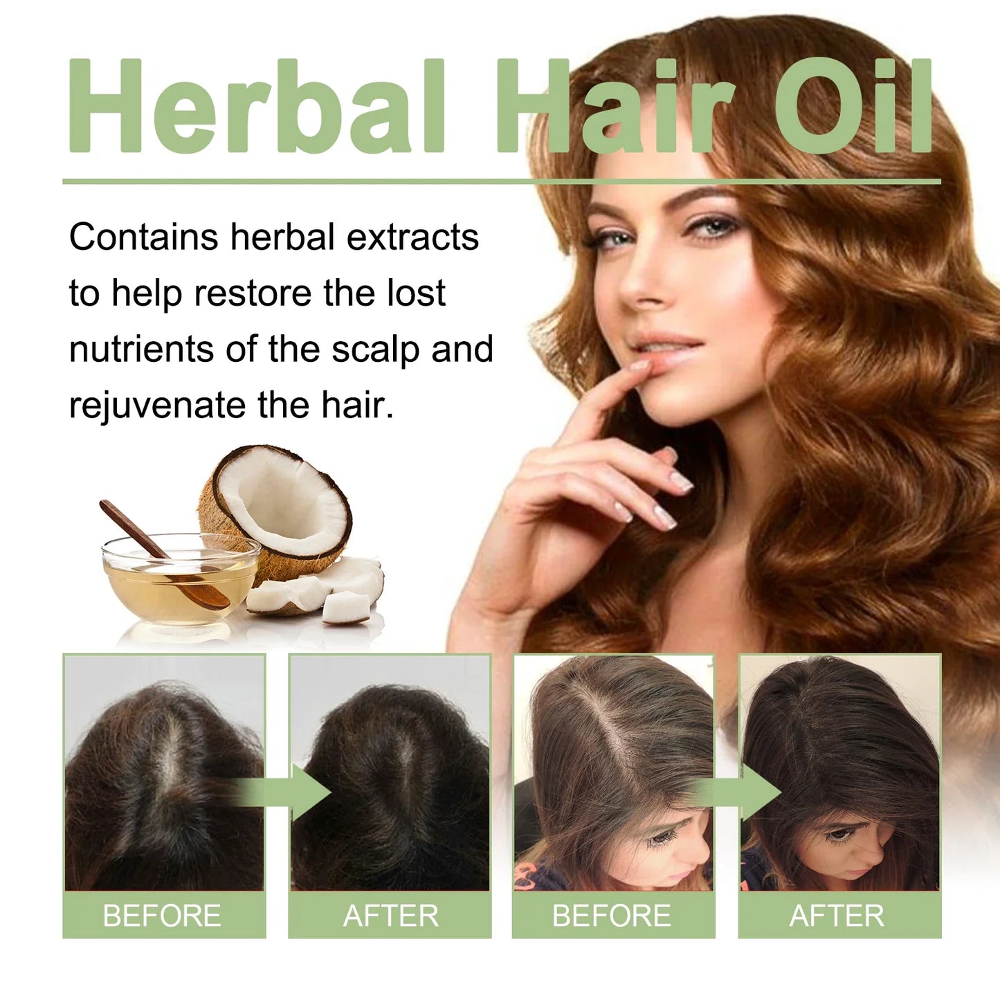 Herbal Hair Growth Oil 100ml - Rosemary Scalp Care Oil for Hydration & Hair Repair