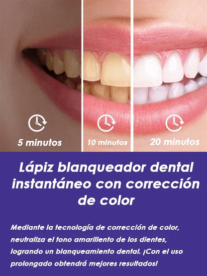 Purple Teeth Whitening Pen - Stain Removal Toothpaste Treatment for a Brighter Smile & Fresh Oral Care