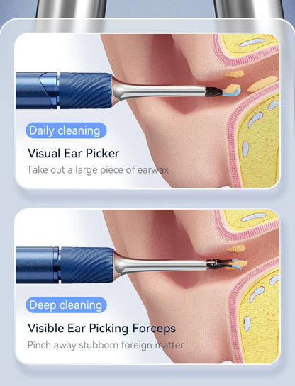 Visual Ear Cleaner with Camera – Ear Wax Removal Tool with 12MP, Ear Pick, Tweezers & 6 Ear Spoons for Ear Care