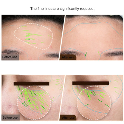 EMS Facial & Body RF Machine – Professional Radio Frequency Beauty Device for Skin Tightening, Face Lifting, and Anti-Aging