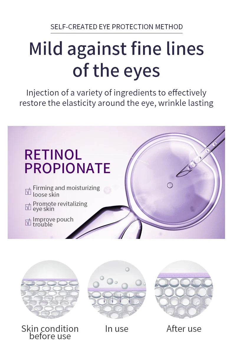 O'CHEAL Anti-Wrinkle Eye Cream Roller – Dark Circle & Puffiness Reducer with Hyaluronic Acid for Anti-Aging Skin Care
