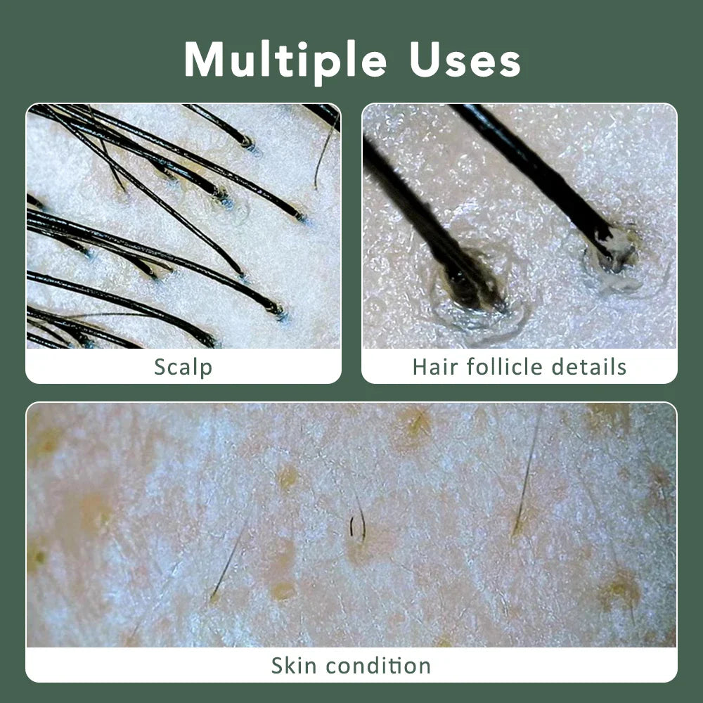 Wireless Dermatoscope Skin Analyzer — 1000X WiFi Magnifier for Scalp & Facial Skin Diagnostics