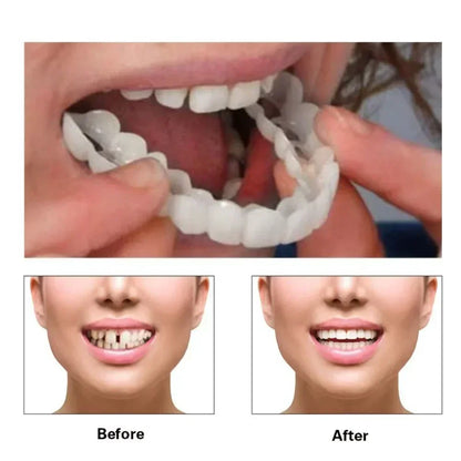 Perfect Fit Teeth Whitening Fake Tooth Cover – Snap-On Silicone Smile Veneers for Upper Teeth, Reusable Cosmetic Tool