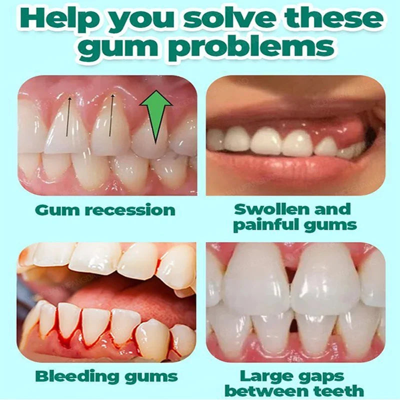 60ML Gum Repair Gel Serum - Sore Gum Relief Dental Care for Teeth Cleaning, Stains, Tartar & Oral Health