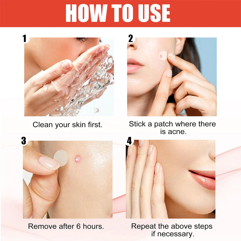 240Pcs Heart & Star Shape Acne Patches - High-End Pimple Dots for Moisturizing & Covering Zits and Blemishes