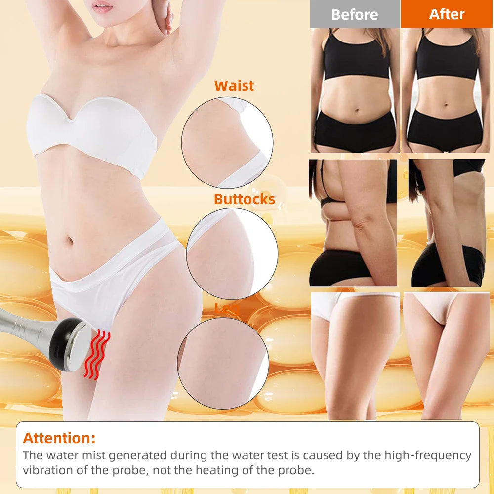 4-in-1 40K Cavitation Body Slimming Machine – Skin Tightening, Face Lifting & Vacuum Massager (Overseas Warehouse)