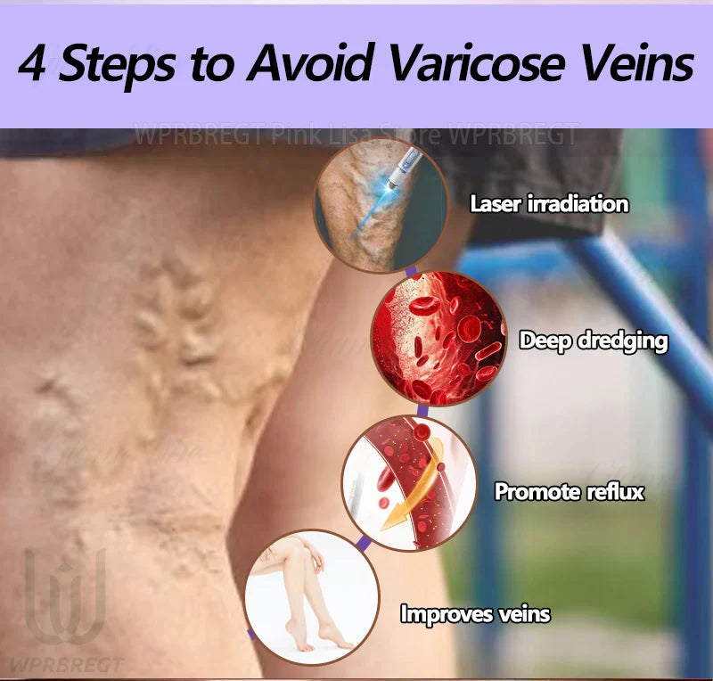 Varicose Vein & Spider Leg Pain Relief Treatment — Painless Care for Vasculitis & Phlebitis