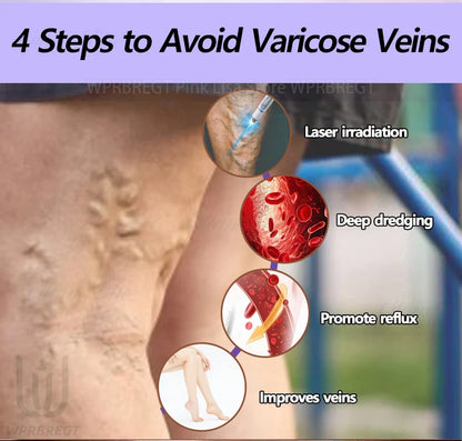 2nd Gen Varicose Vein Laser Therapy Device – Relieves Spider Leg Pain, Treats Vasculitis & Phlebitis