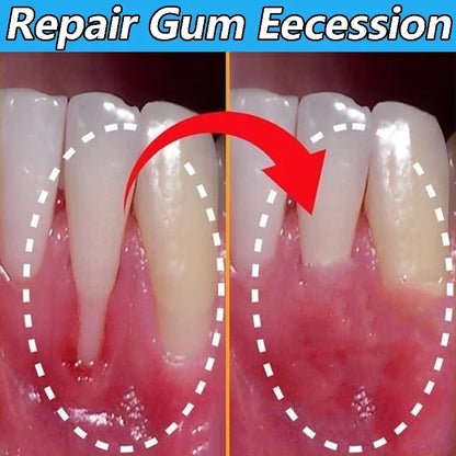 60ML Gum Repair Gel Serum - Sore Gum Relief Dental Care for Teeth Cleaning, Stains, Tartar & Oral Health