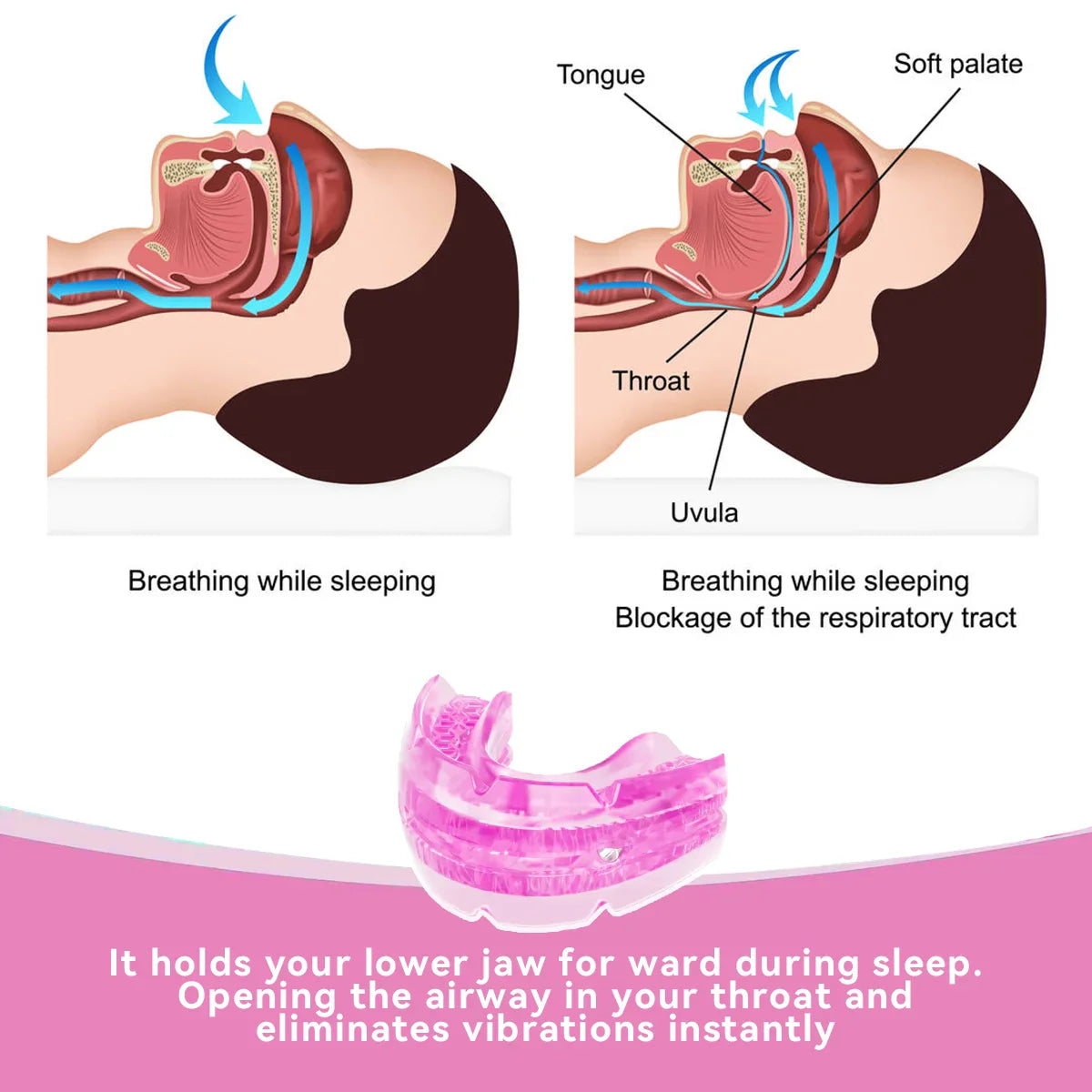 Adjustable Anti-Snoring Mouth Guard – Sleep Aid Mouthpiece for Bruxism, Anti-Apnea & Snoring Relief
