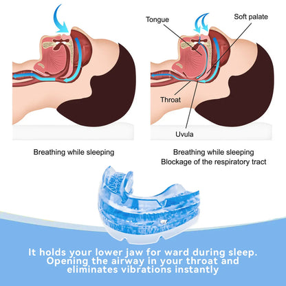Anti-Snore Mouth Guard for Bruxism – Stop Snoring & Sleep Apnea Aid, Teeth Protection Night Mouthpiece