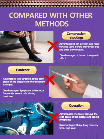 2nd Gen Varicose Vein Laser Therapy Device – Relieves Spider Leg Pain, Treats Vasculitis & Phlebitis