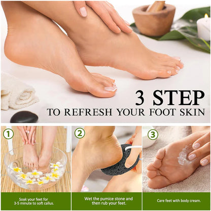 Natural Lava Pumice Stone Callus Remover — Foot, Heel & Palm Exfoliating Scrubber for Hard Skin Care