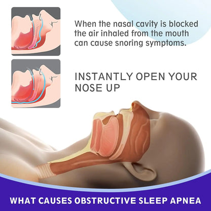10/30/50/200pcs Nasal Strips — Extra Strength Transparent Anti-Snoring Patches for Better Sleep