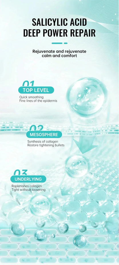 Salicylic Acid Acne Removal Cream – Anti-Acne, Redness Repair, Deep Cleaning & Oil Control Skincare