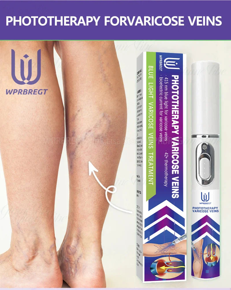 Varicose Vein & Spider Leg Pain Relief Treatment — Painless Care for Vasculitis & Phlebitis
