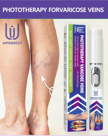 2nd Gen Varicose Vein Laser Therapy Device – Relieves Spider Leg Pain, Treats Vasculitis & Phlebitis
