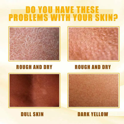 Body Care Exfoliating Yellow Peeling Oil – 100% Organic Dark Skin Whitening Serum for Dark Knuckles and Fast Bleaching