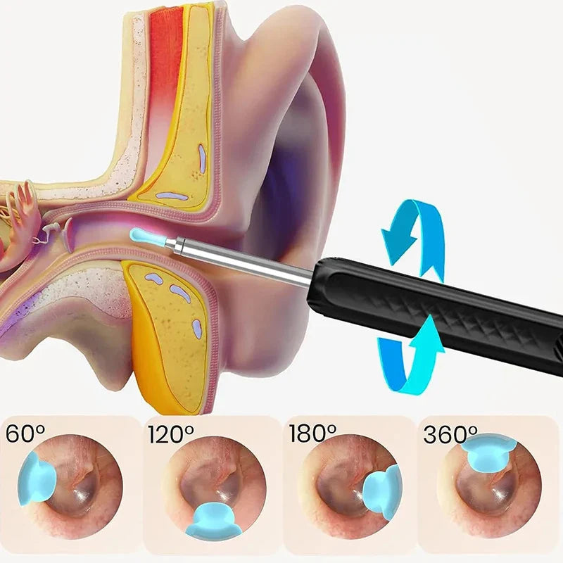 Wireless WiFi Ear Pick Otoscope Camera – Luminous Ear Wax Cleaner & Oral Inspection Health Care Kit