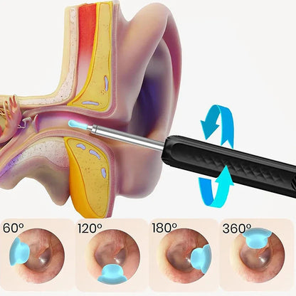 Wireless WiFi Ear Pick Otoscope Camera – Luminous Ear Wax Cleaner & Oral Inspection Health Care Kit