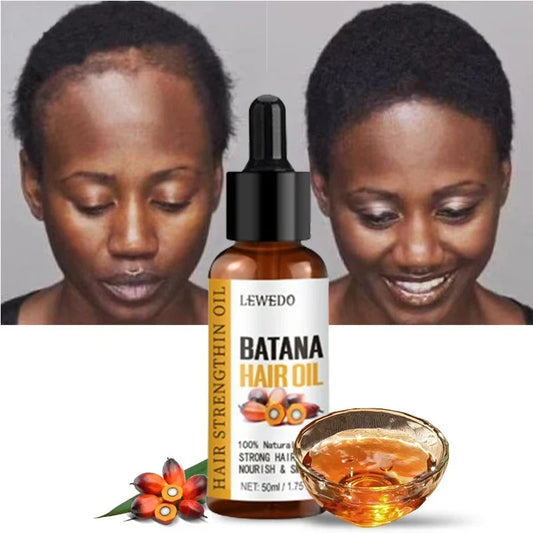 Lewedo Naturals Batana Oil - Pure Hair Care Treatment for Men & Women Nourishing Shiny Hair & Scalp Support
