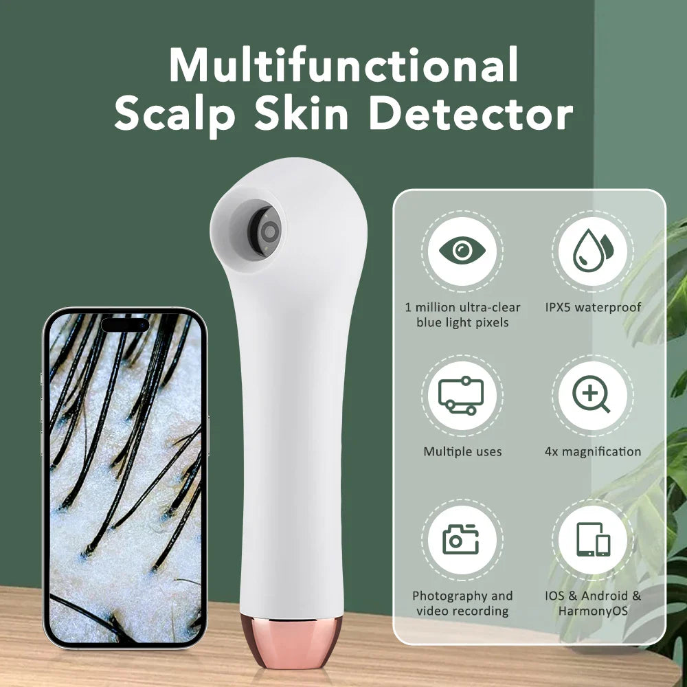 Multifunctional HD Scalp & Skin Analyzer — Hair Follicle Detector with Magnifier for Phone & Tablet