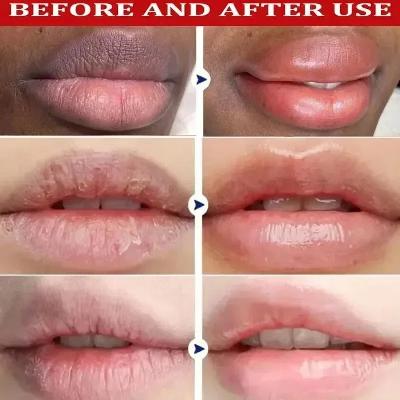 Dark Lip Lightening Balm & Exfoliating Lip Mask – Moisturizing Treatment to Reduce Lines, Improve Dryness & Restore Natural Pink Lips