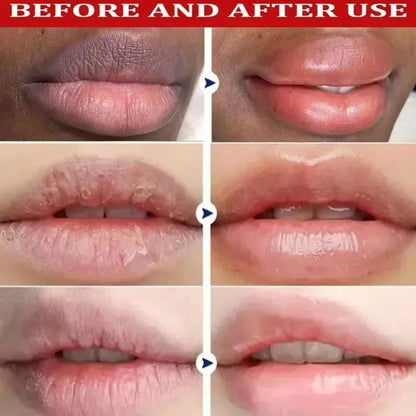 Dark Lip Lightening Balm & Exfoliating Lip Mask – Moisturizing Treatment to Reduce Lines, Improve Dryness & Restore Natural Pink Lips