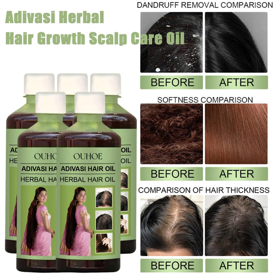 Herbal Hair Growth Oil 100ml - Rosemary Scalp Care Oil for Hydration & Hair Repair