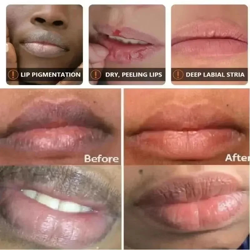 Brightening Melanin-Removing Lipstick – Moisturizing Lip Care with Dead Skin Exfoliation & Nourishing Essence, 8.5g