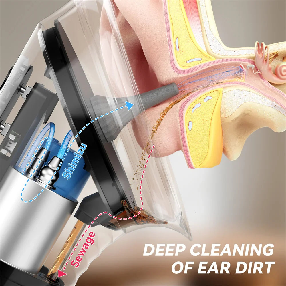 Upgraded Ear Wax Removal Kit – Intelligent Ear Cleaner with Waste Water Tank & Temperature Sensor, Safe Low-Pressure Ear Irrigation System for Effective Wax Cleaning