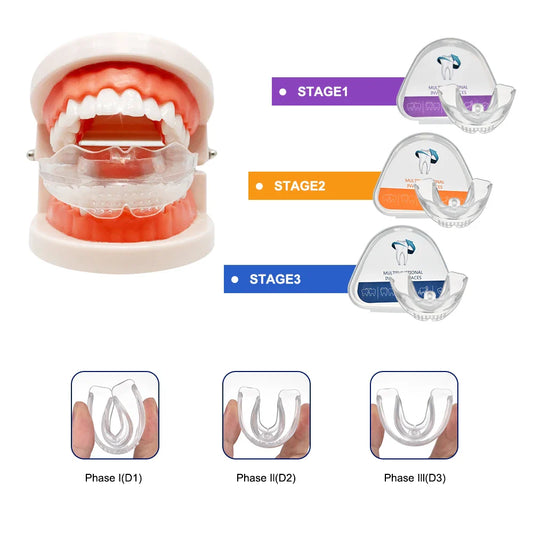 3 Stage Dental Braces Teeth Trainer – Orthodontic Alignment Mouthpiece for Adults, Tooth Straightener