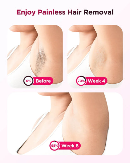 990000 Flash Laser IPL Hair Removal Machine – Painless Permanent Body & Facial Epilator for Men & Women | Bikini, Underarm & Full Body At-Home Hair Remover Device