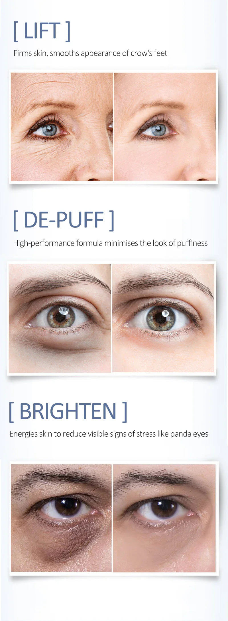 OCHEAL Eye Moisturizing Cream – Anti-Aging Serum for Dark Circles, Fine Lines, Puffiness, and Firmness