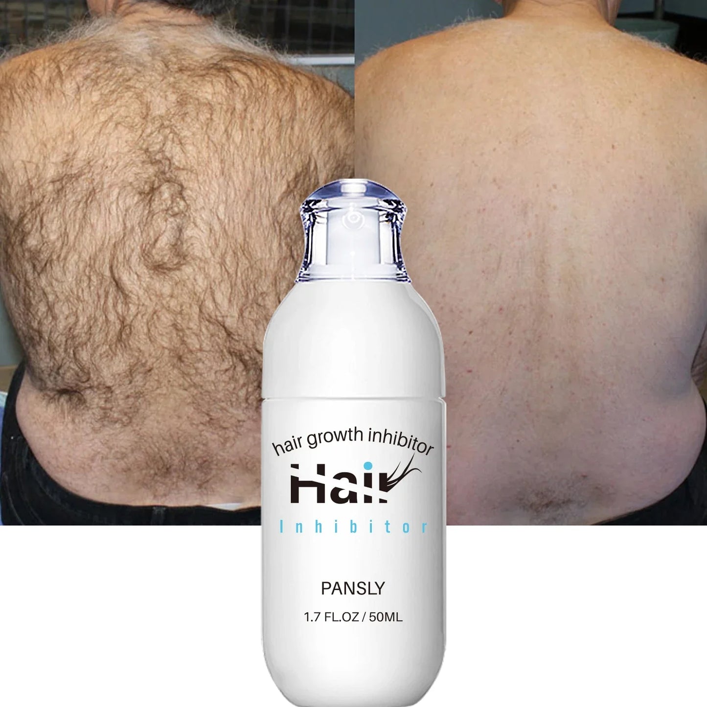 100ML Hair Removal Spray - Painless Hair Reduction Treatment for Smooth Skin and Hair Growth Inhibition