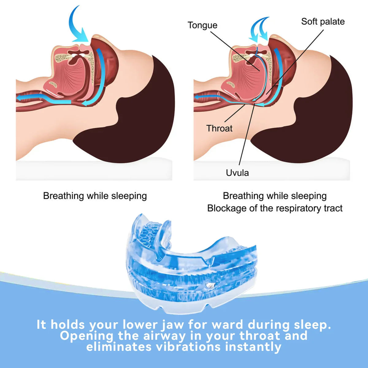 Adjustable Anti-Snoring Mouth Guard – Sleep Aid Mouthpiece for Bruxism, Anti-Apnea & Snoring Relief