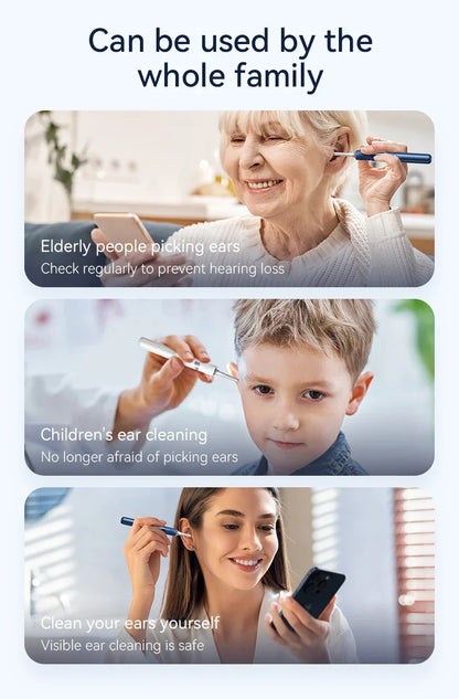 Visual Ear Cleaner with Camera – 12MP Ear Wax Removal Tool with Ear Pick, Tweezers & 6 Ear Spoons for Ear Care